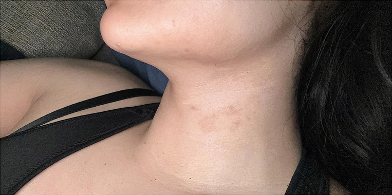 Image #2 from Liv