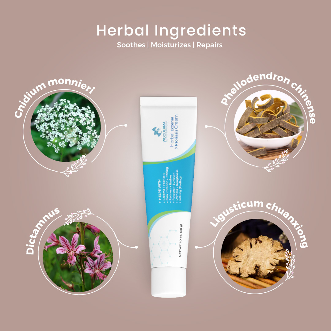 Herbal Eczema & Psoriasis Relief Cream - Image 4
